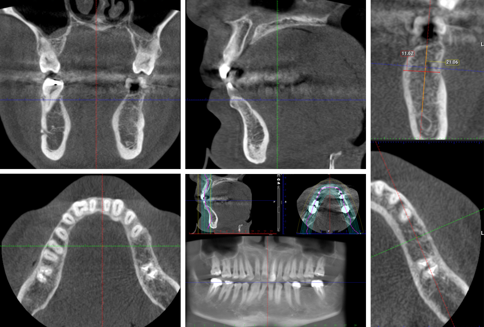 News CT scan vs. Cone Beam CT an overview News CT scan vs. Cone Beam CT an overview