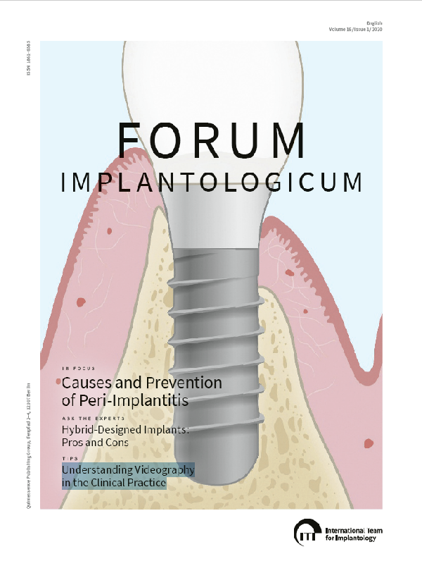 ITI Treatment Guide: Loading Protocols in Implant Dentistry