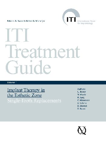 ITI Treatment Guide Volume 10 - Home - ITI