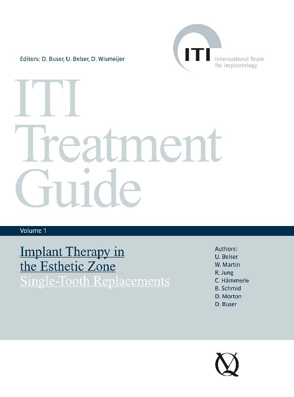 ITI Treatment Guide Volume 1 - Home - ITI ITI Treatment Guide Volume 1 - Home - ITI