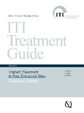 ITI Treatment Guide Volume 1 ※非裁断 ITI Treatment Guide Volume 1 - Home - ITI