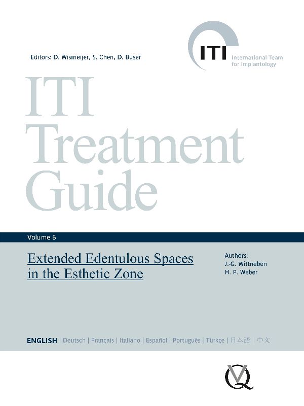 ITI Treatment Guide Volume 6 - Home - ITI