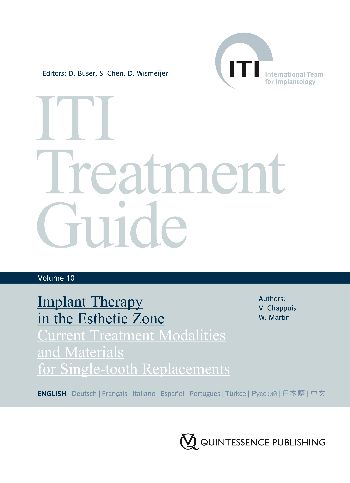 健康・医学 ITI Treatment Guide 10 ITI Treatment Guide Volume 10 - Home - ITI
