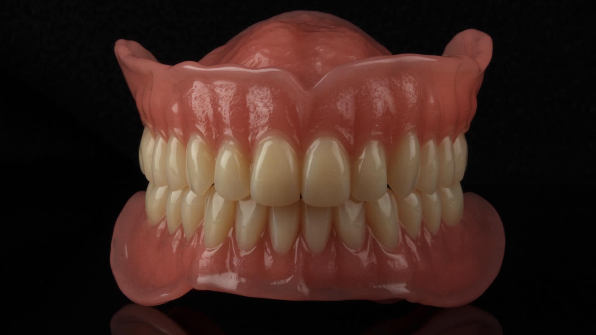 CAD-CAD milled complete denture